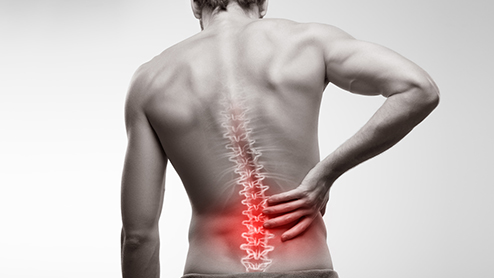 Back Pain - Causes, Symptoms
